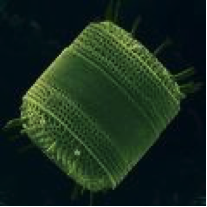 photo of silica diatom test